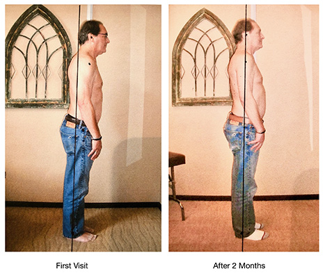 Chiropractic Issaquah WA Dan Posture